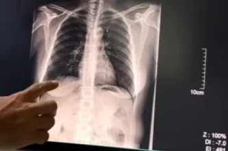 El 40% de los pacientes que accedieron al Consultorio de Cesación Tabáquica dejaron de fumar