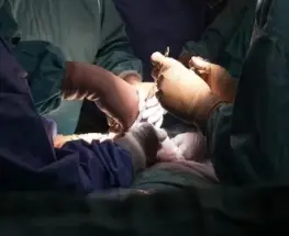 El Garrahan realizó por primera vez una transfusión intrauterina en un caso de anemia fetal severa