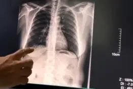 Más de 80 personas dejaron de fumar gracias al consultorio del Hospital Marcial Quiroga