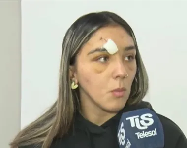 Una jugadora de Argentino debió costear su atención tras un fuerte choque en el Apertura