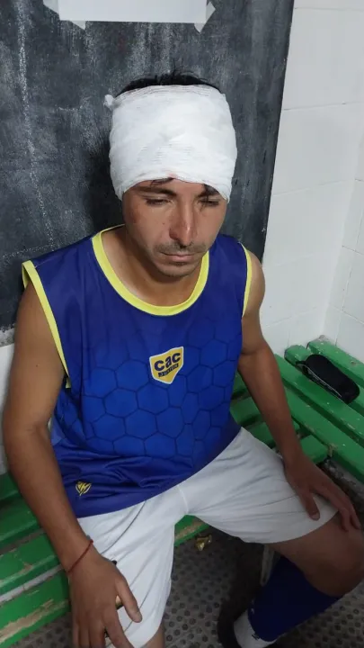 Jugador de Colon Agredido Gonzalo Quiroga 1.jpg.jpeg