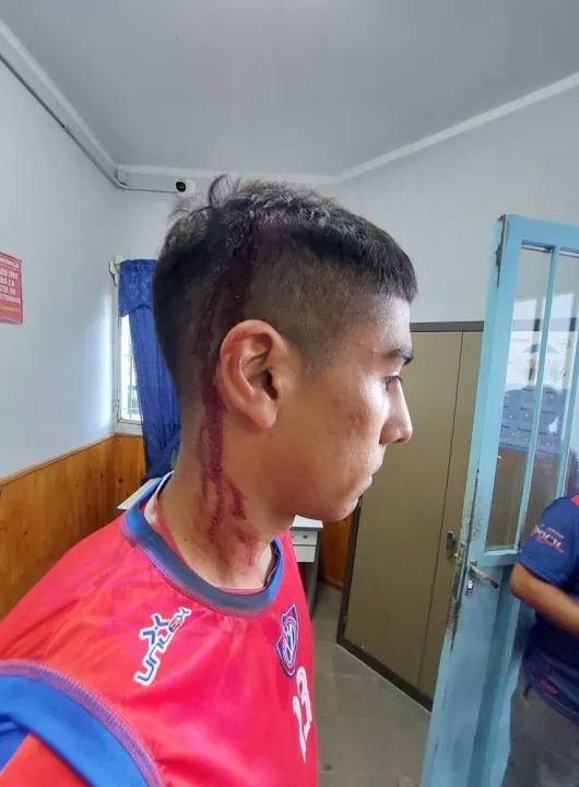 Villa Hipodromo agredidos 4.jpg