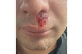 Un policía terminó hospitalizado tras sufrir un ataque con piedrazos