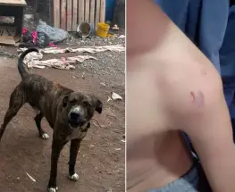 Un niño de 3 años sufrió heridas graves tras el ataque de un perro en Rawson